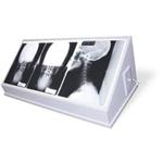X-Ray Illuminators/View Boxes