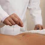 Pellets & Press Needles Pellets & Press Needles