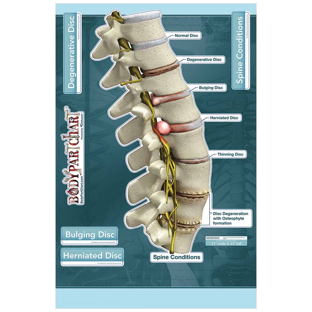 BodyPartChartSpineConditions-LabeledWallDecal