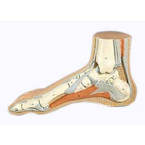 NormalFoot
