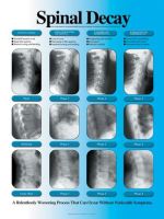 Spinal Decay Chart, Laminated