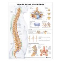 Human Spine Disoders 20 X 26 Laminate
