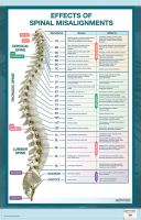 Effects of Spinal Misalignment