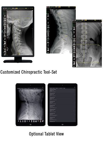 Customized Chiropractic PACS Tool Set