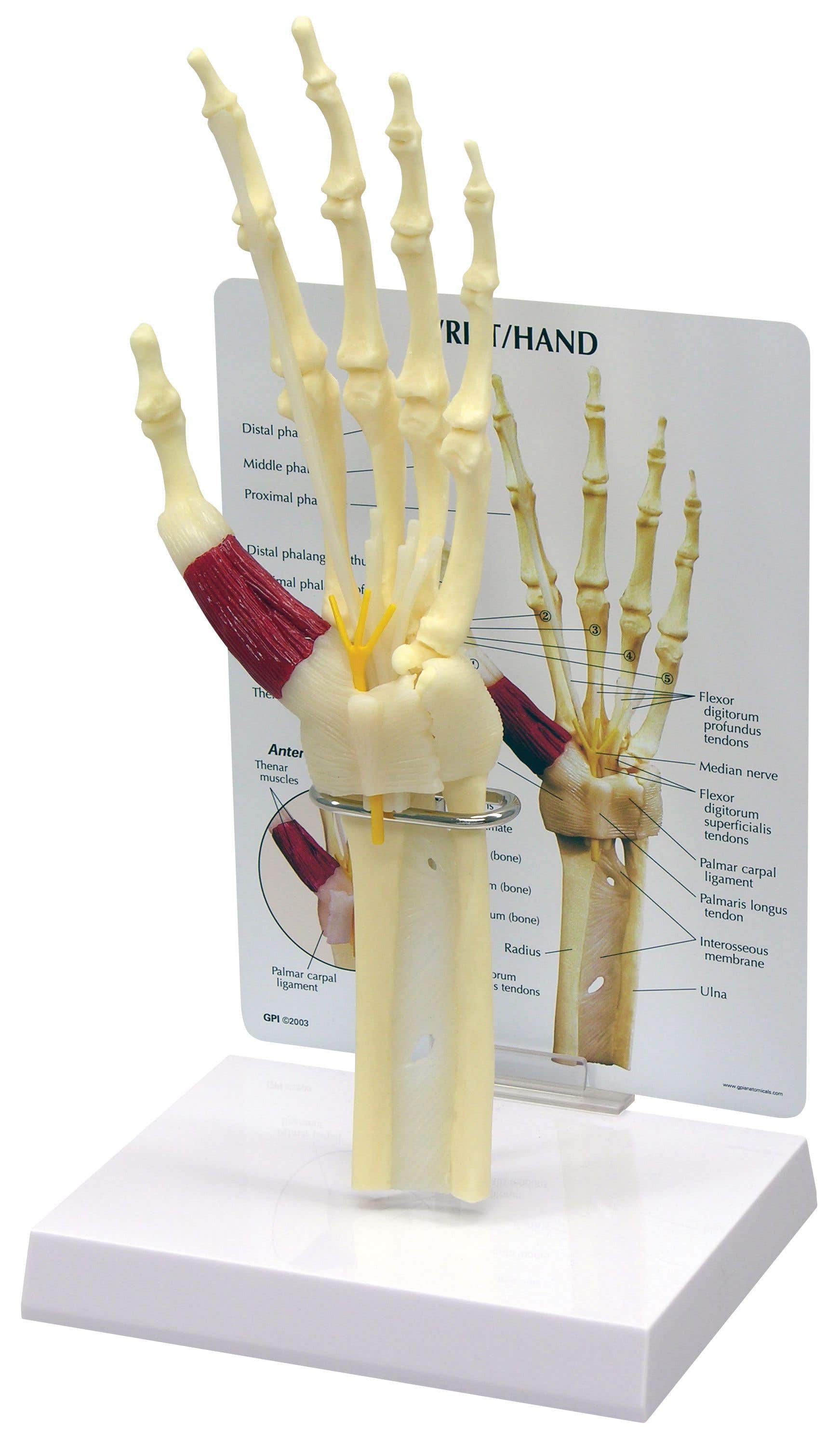 Hand/WristCarpalTunnelSyndromeW/KeyCard