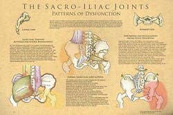 The Sacroiliac Joints: Patterns Of Dysfunction