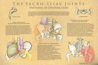The Sacroiliac Joints: Patterns Of Dysfunction