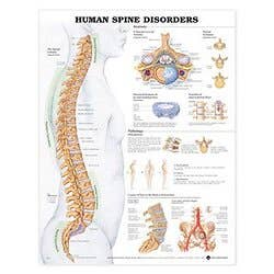 Human Spine Disoders 20" X 26" Laminate
