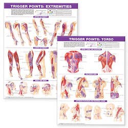 Laminated Trigger Points, Torso And Extremities