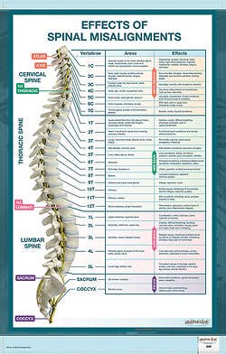 Effects of Spinal Misalignment
