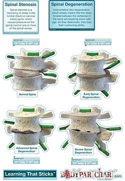 BodyPartChart Spinal Degeneration